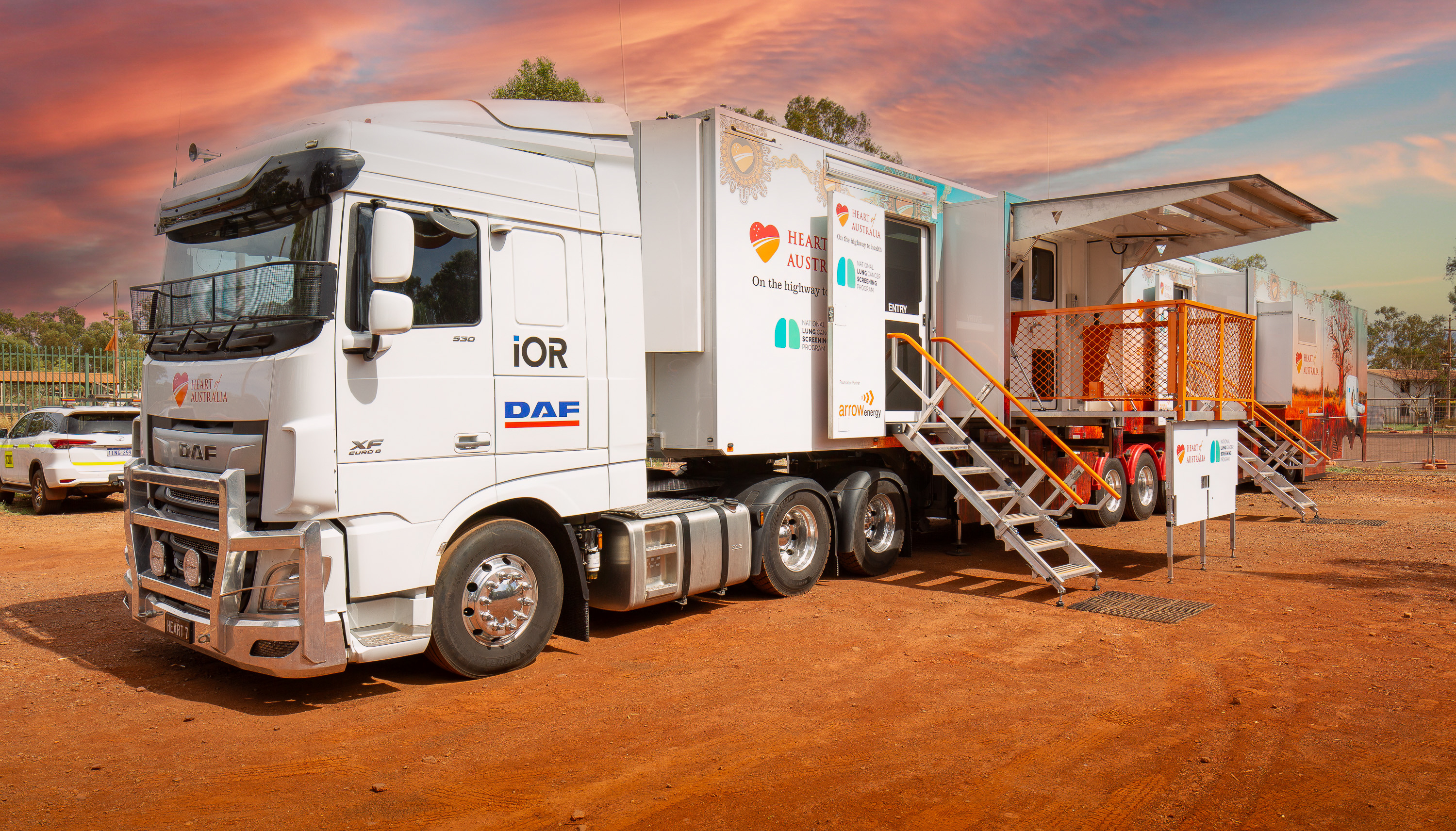 Paraburdoo Heart of Australia National Lung Cancer Screening Program